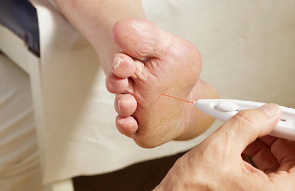 protocole diabétiques de type 2